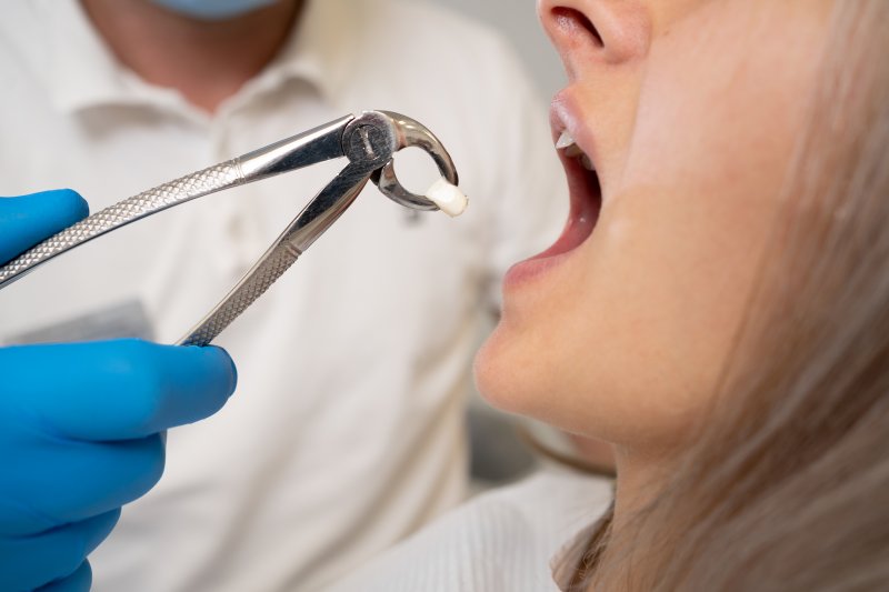 A closeup of dental forceps after a tooth extraction